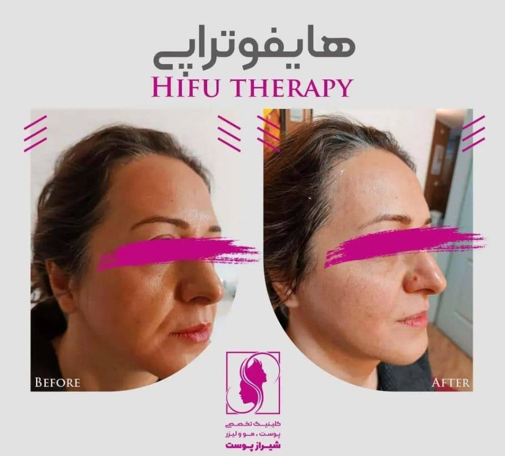 کلینیک زیبایی پوست و مو شیراز پوست زارع در شیراز