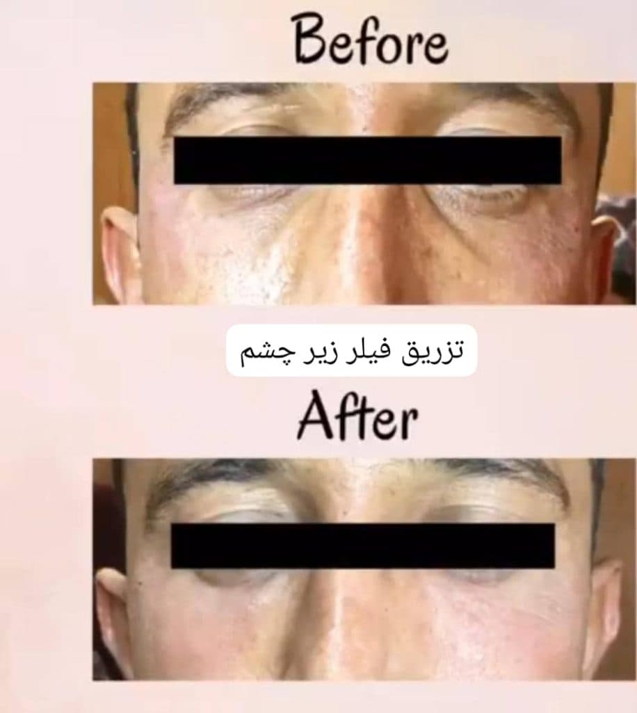 کلینیک زیبایی پوست و مو شیراز پوست زارع در شیراز