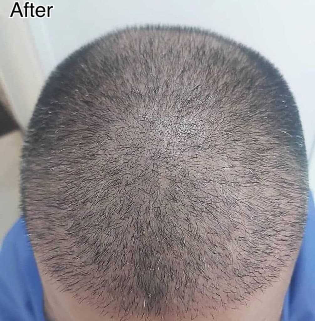 کلینیک زیبایی پوست و مو بهتا در کرج