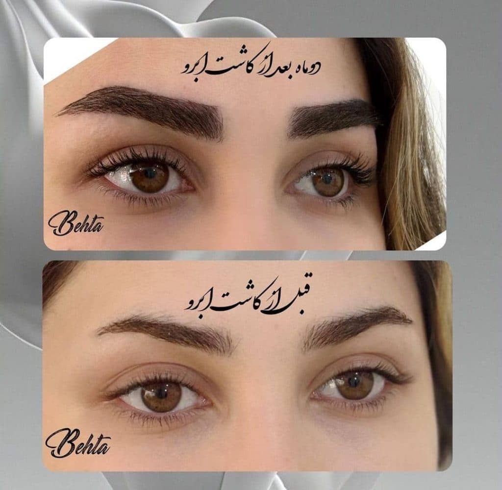 کلینیک زیبایی پوست و مو بهتا در کرج