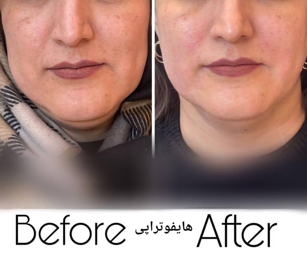 کلینیک زیبایی پوست و مو الماس در مشهد