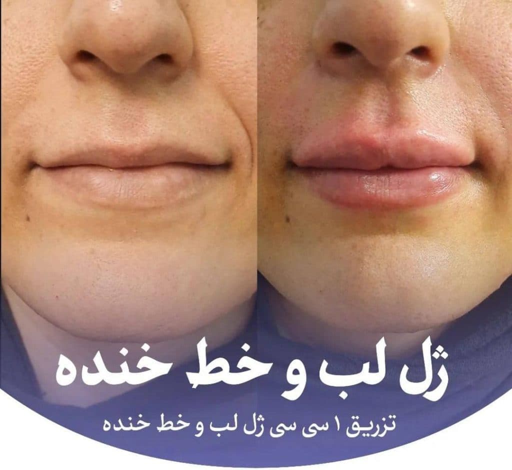 کلینیک زیبایی و لیزر تندیس در باغستان غربی کرج