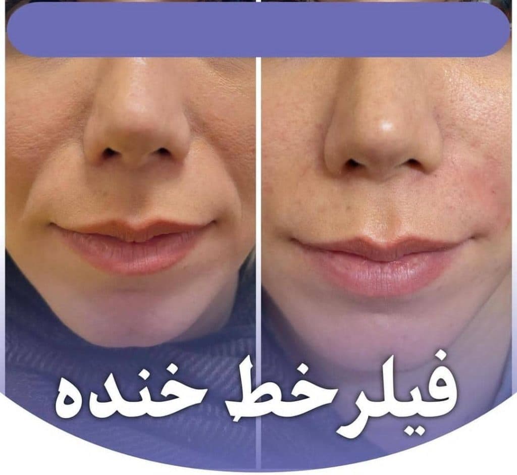 کلینیک زیبایی و لیزر تندیس در باغستان غربی کرج