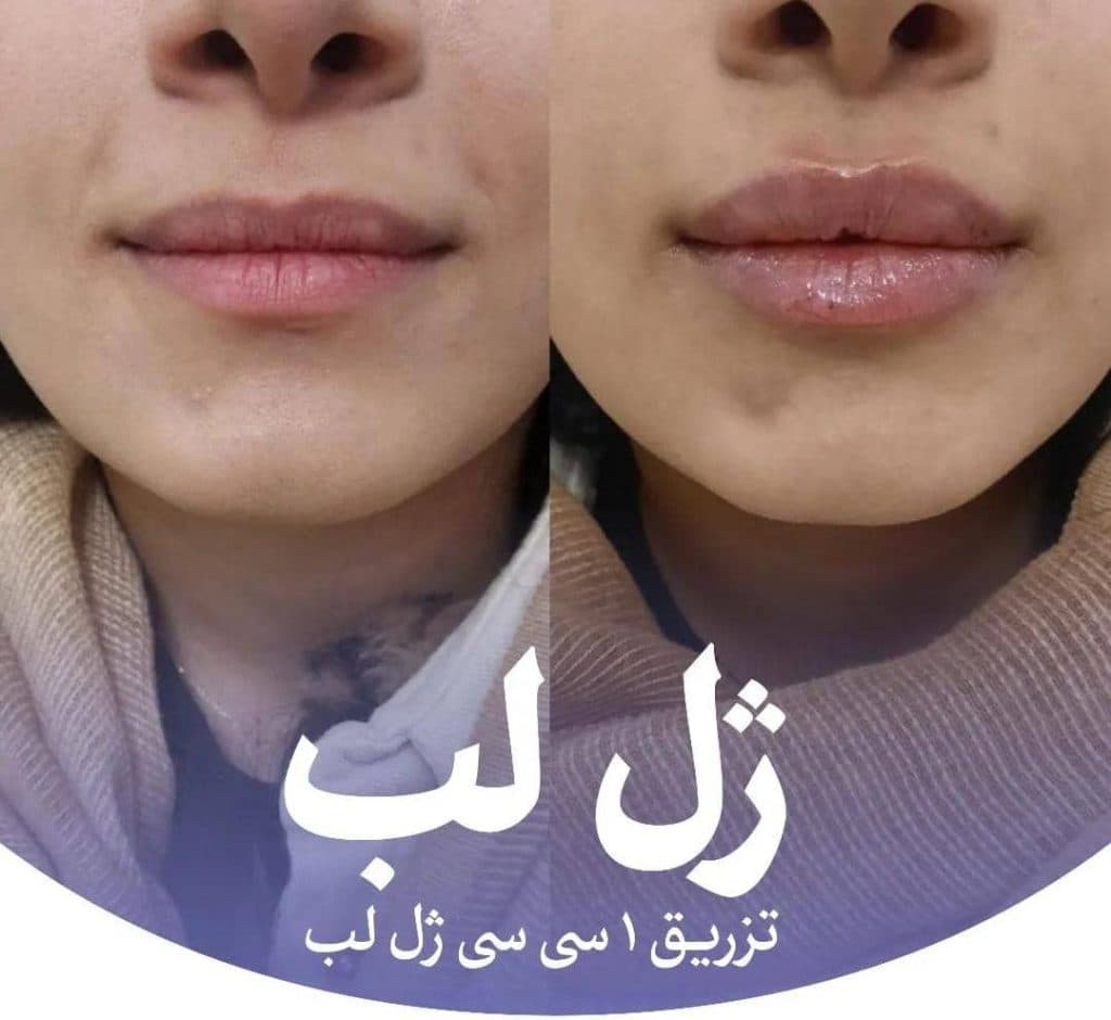 کلینیک زیبایی و لیزر تندیس در باغستان غربی کرج