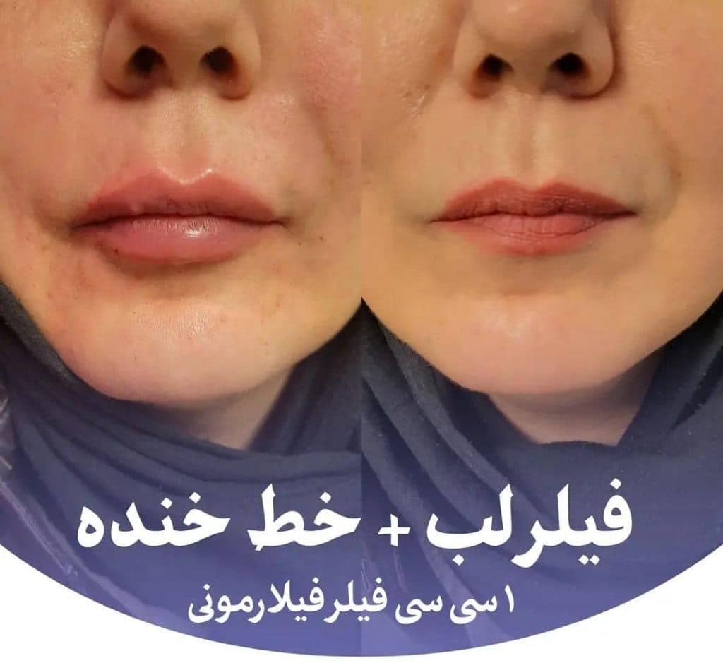 کلینیک زیبایی و لیزر تندیس در باغستان غربی کرج