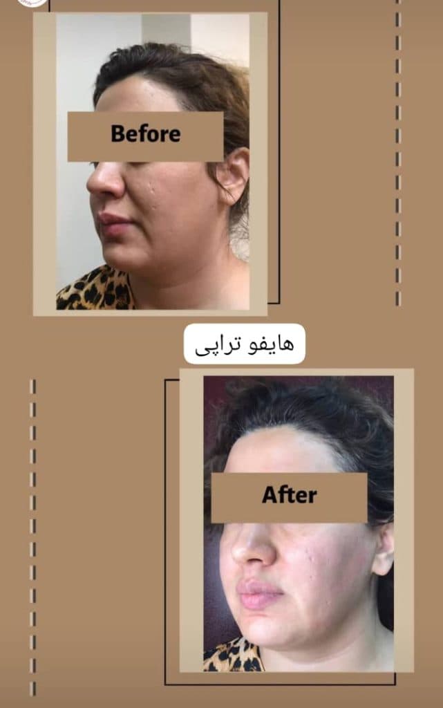 کلینیک زیبایی پوست و مو مروا در کرج