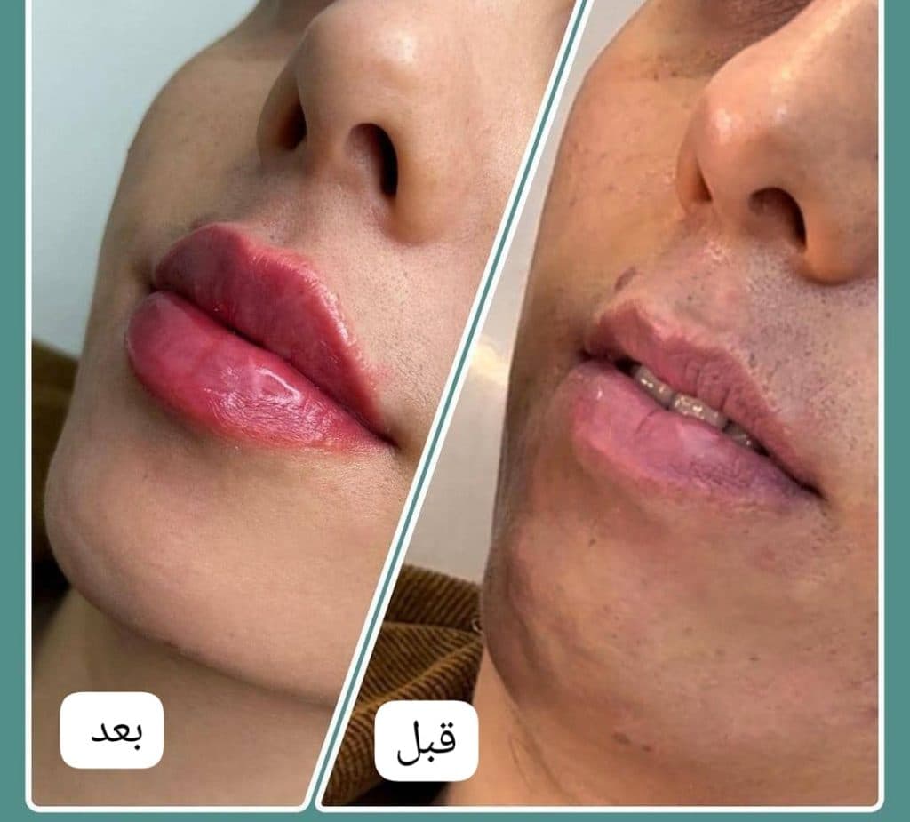 کلینیک زیبایی پوست و مو مانلی در کرج