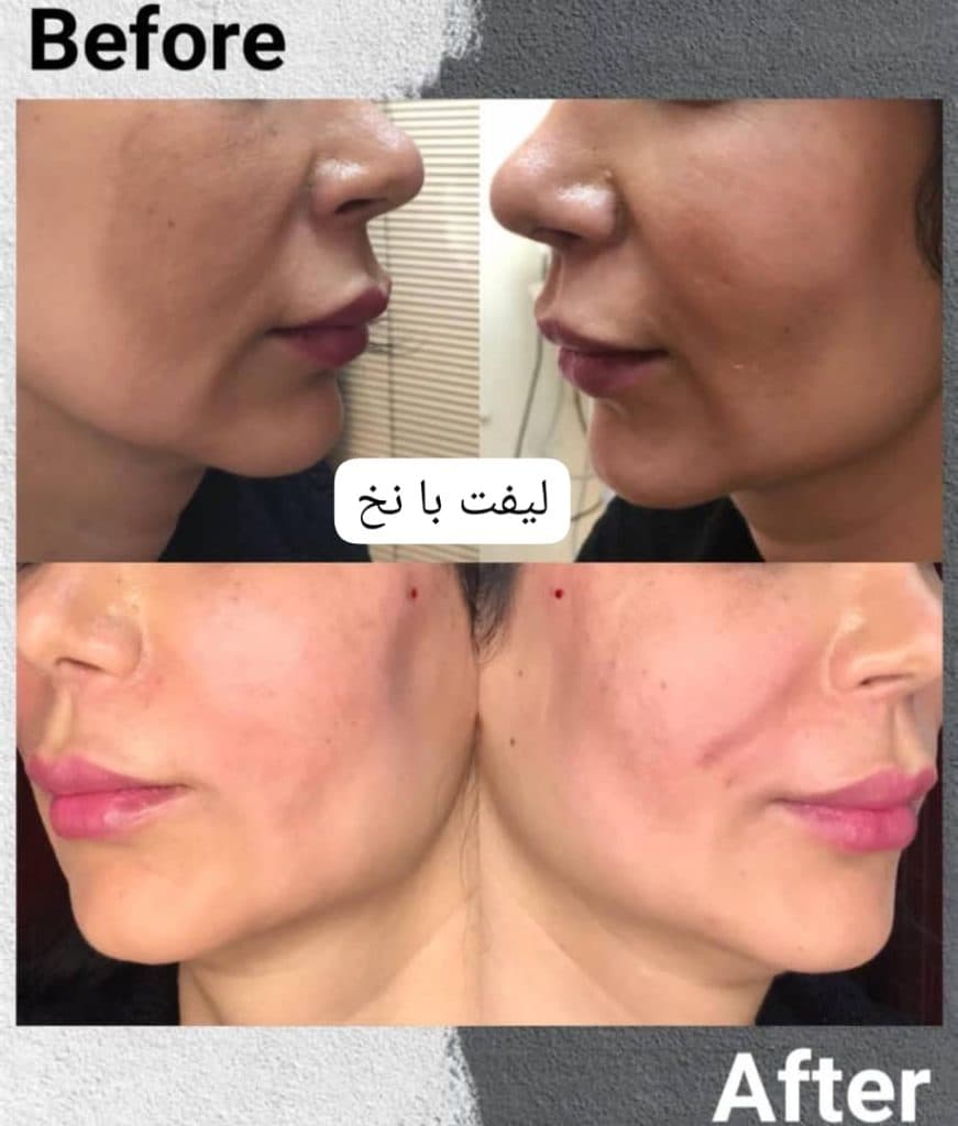 کلینیک زیبایی پوست و مو مروا در کرج