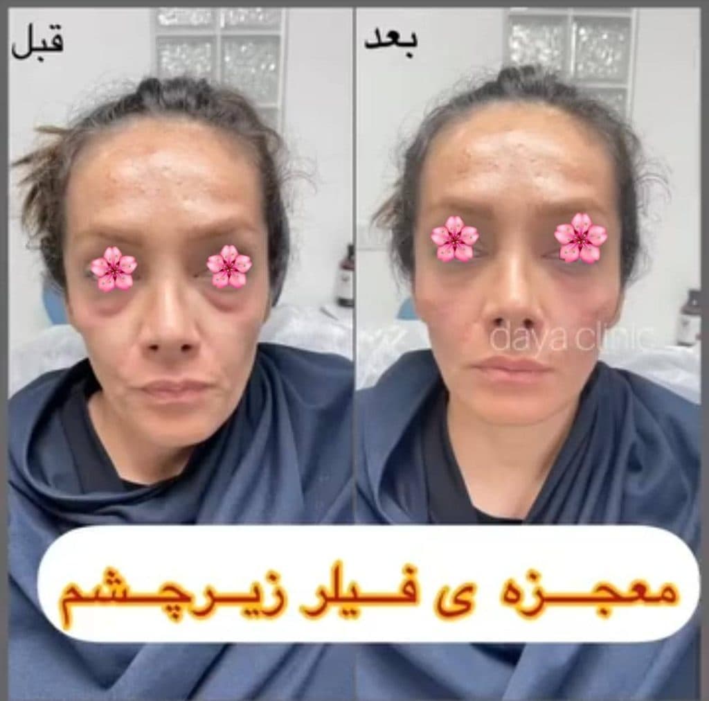 کلینیک زیبایی پوست و مو دایا در کرج