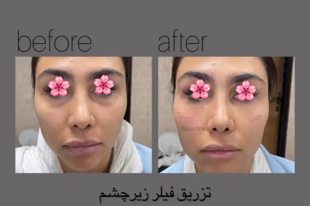 کلینیک زیبایی پوست و مو دایا در کرج