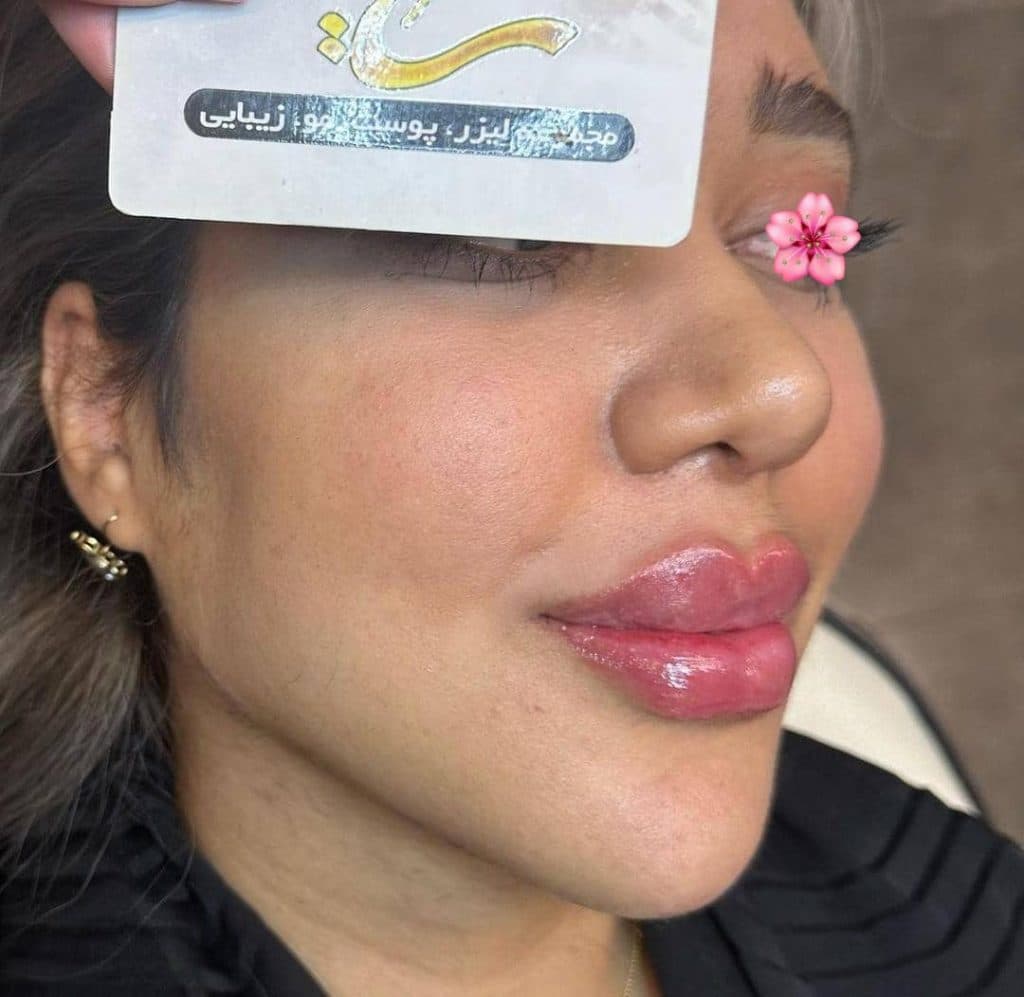 کلینیک زیبایی پوست و مو سایه در مشهد