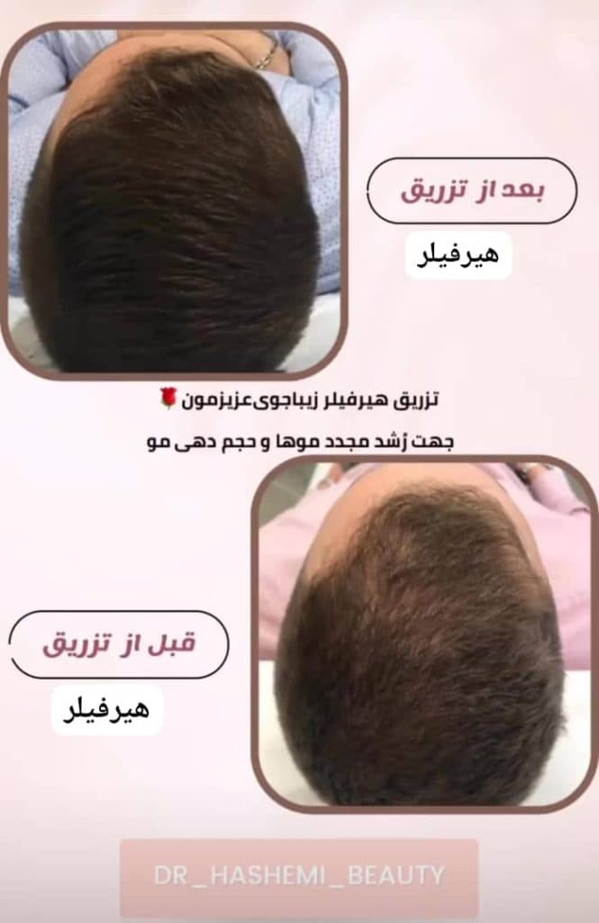 مطب زیبایی پوست و مو دکتر مریم هاشمی عطار در مشهد