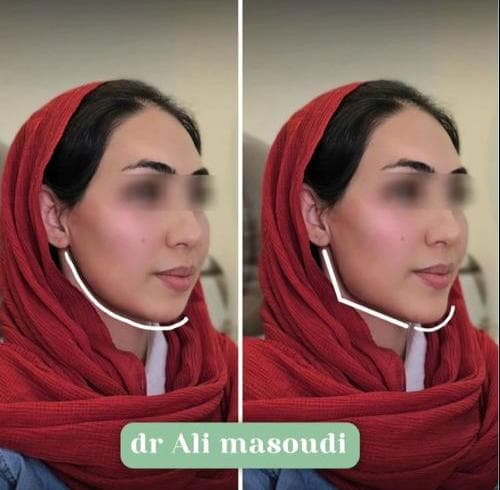 کلینیک زیبایی دکتر علی مسعودی در کوی وحدت شیراز