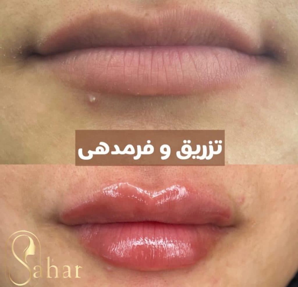 کلینیک زیبایی سحر در قریشی شمالی فردیس کرج