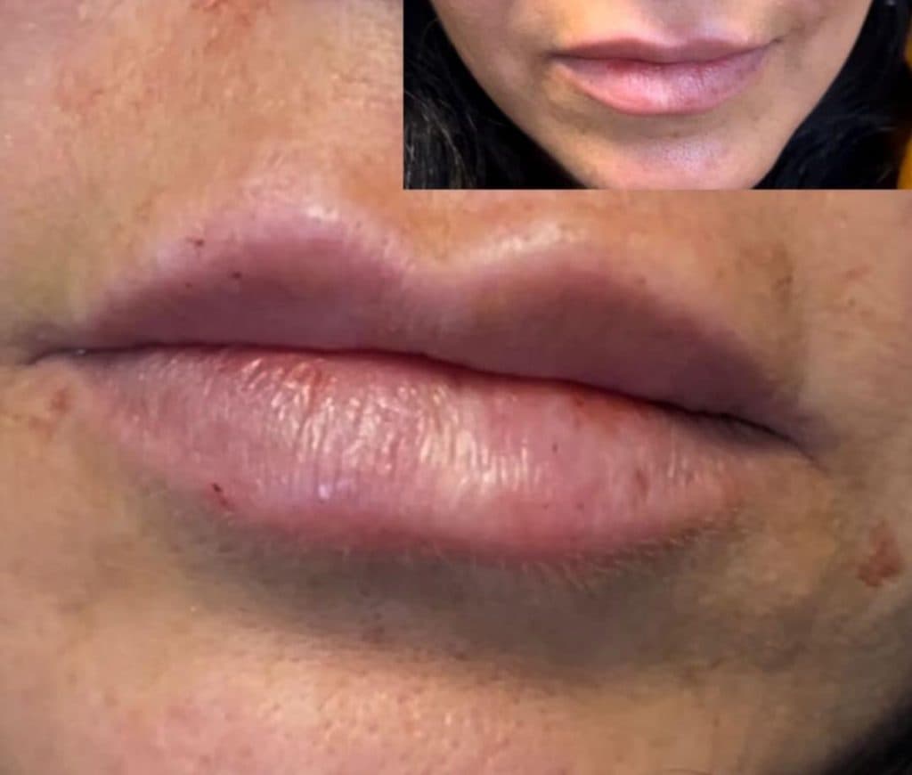 مطب زیبایی دکتر رضا محمدی در امیرکبیر شیراز