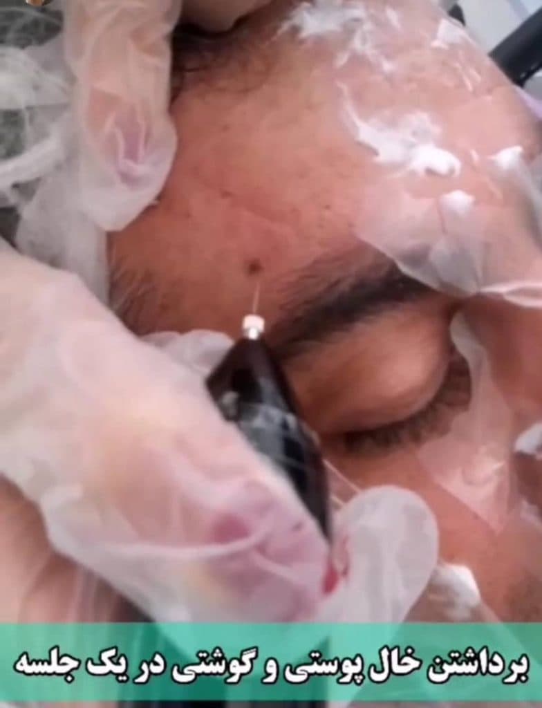 خدمات زیبایی و فیشیال پوست سحر چناری در معالی آباد شیراز