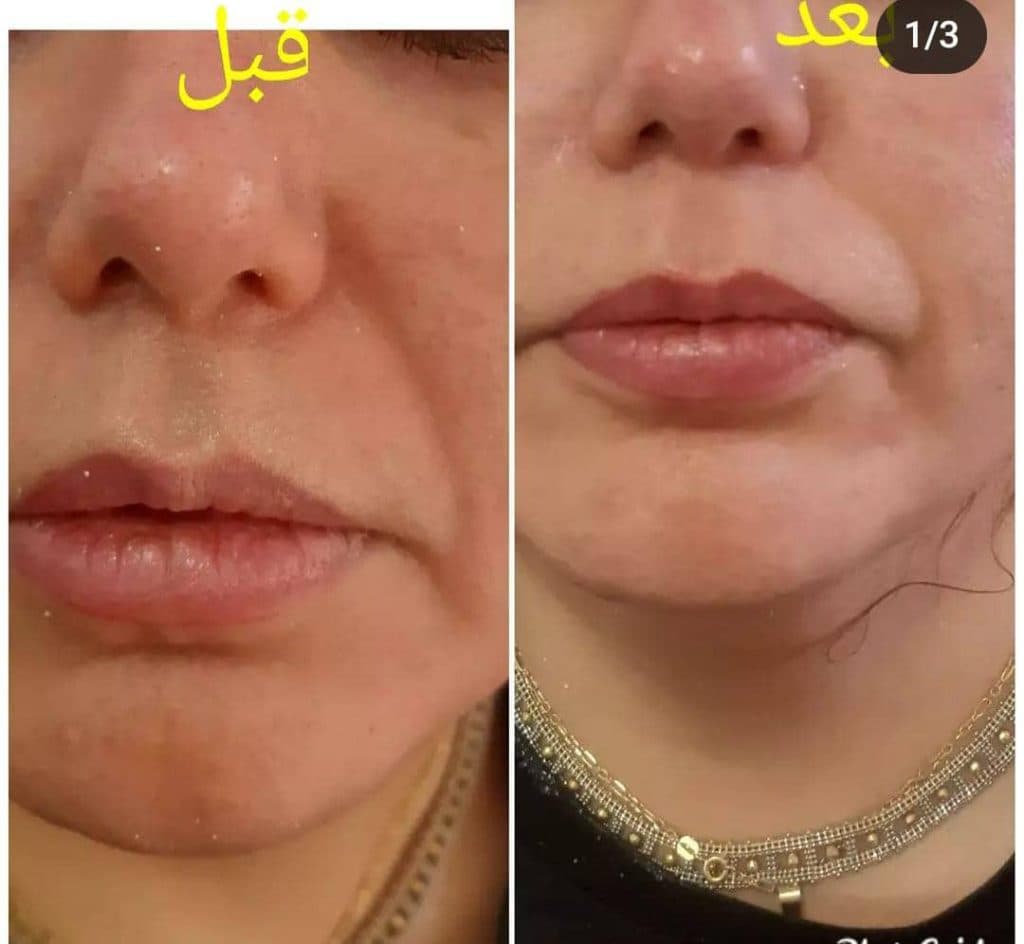 خدمات زیبایی و فیشیال پوست سحر چناری در معالی آباد شیراز