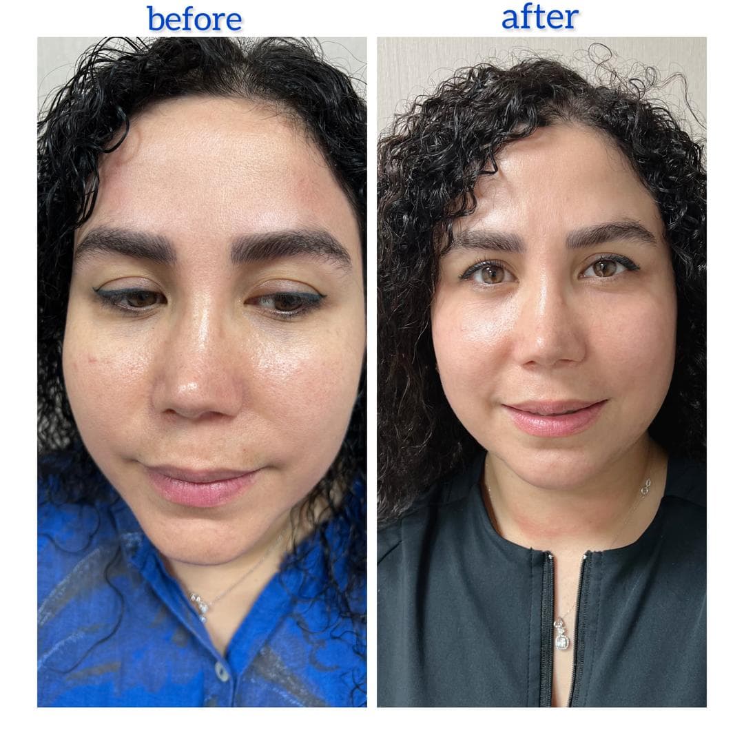 کلینیک لیزر و زیبایی الهام رشت