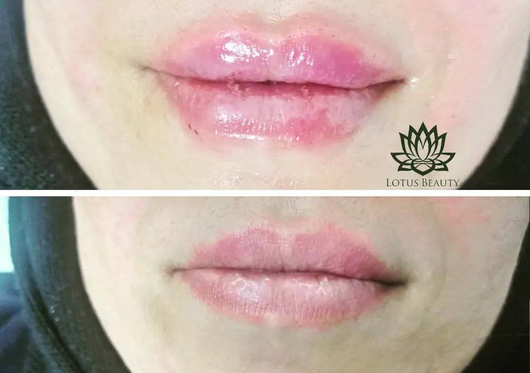 کلینیک زیبایی و لاغری لوتوس دکتر حصاری در بجنورد