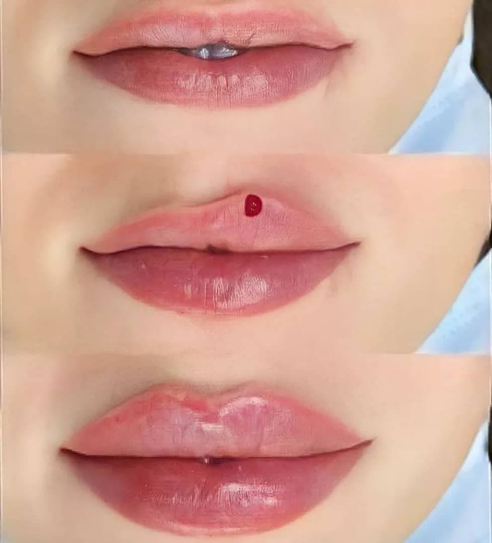 کلینیک زیبایی و لاغری لوتوس دکتر حصاری در بجنورد