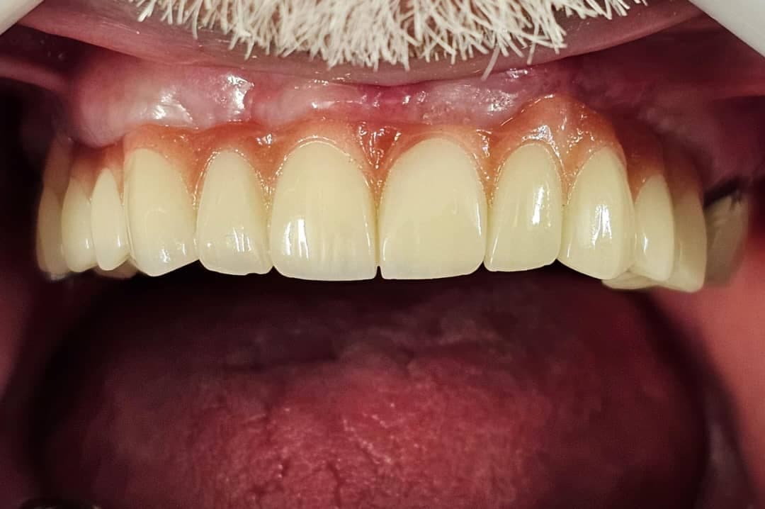 مطب دندانپزشکی تخصصی دکتر بنیکا عباسی در اصفهان