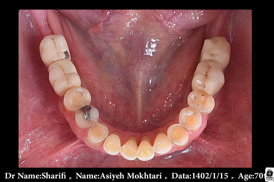 مطب دندانپزشکی تخصصی دکتر مرتضی شریفی در اصفهان