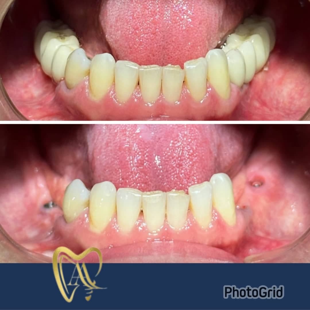 مطب دندانپزشکی تخصصی دکتر سید علی عرب در لاهیجان