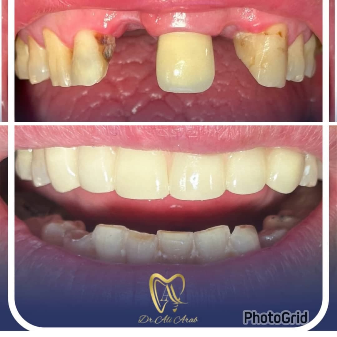 مطب دندانپزشکی تخصصی دکتر سید علی عرب در لاهیجان