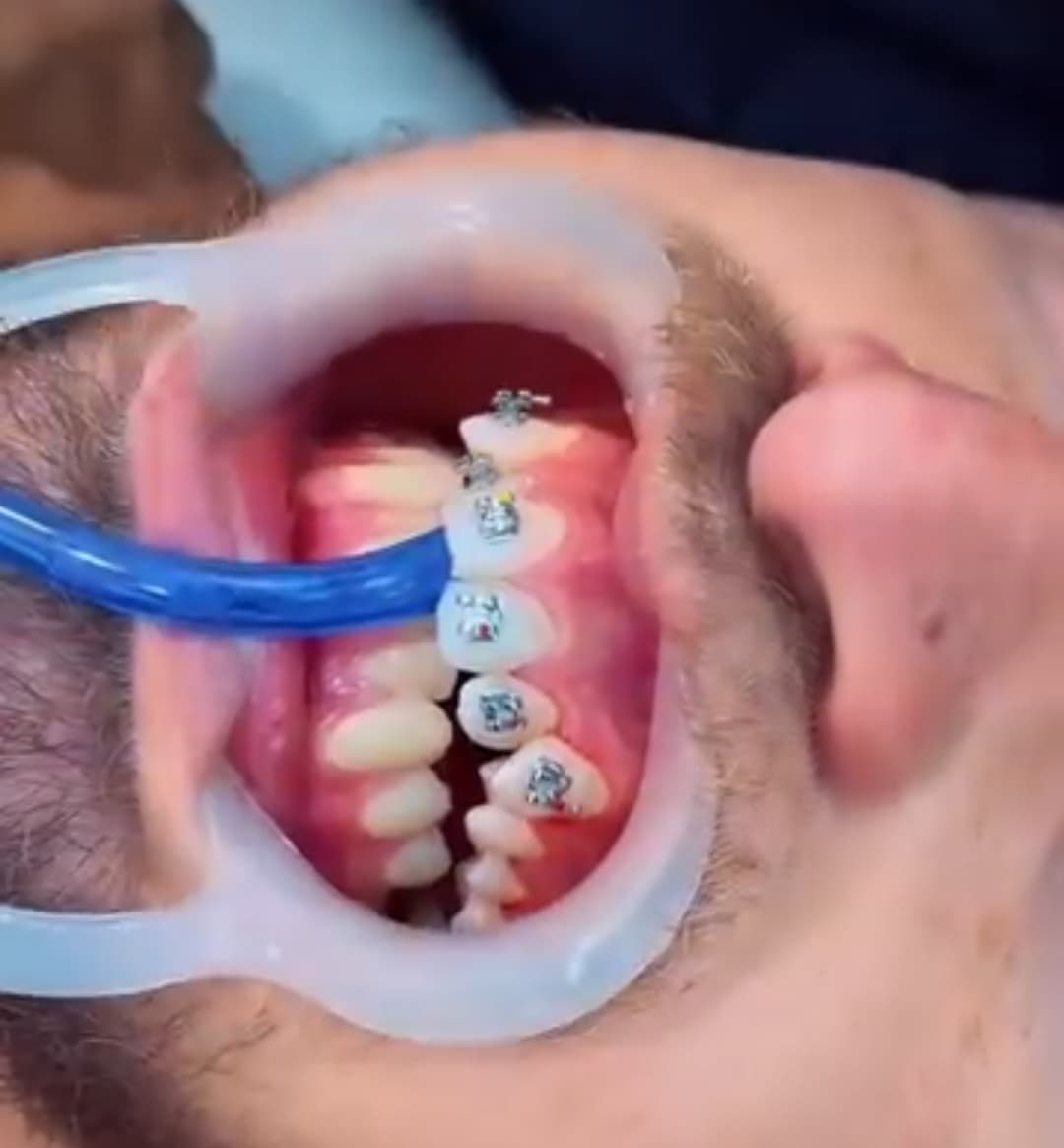 مطب تخصصی ارتودنسی دکتر محمد صادق نظری در خرم آباد