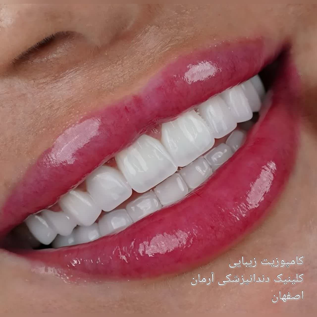 کلینیک دندانپزشکی آرمان اصفهان