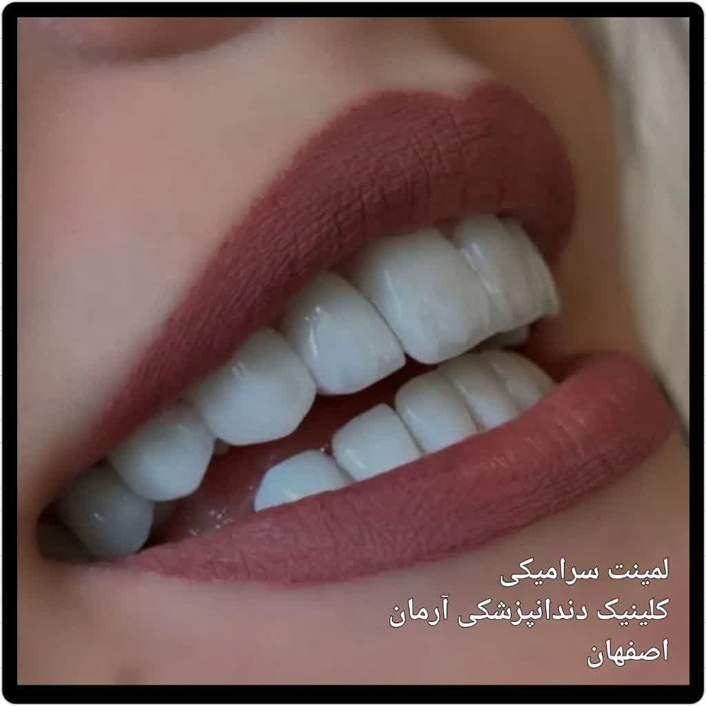کلینیک دندانپزشکی آرمان اصفهان