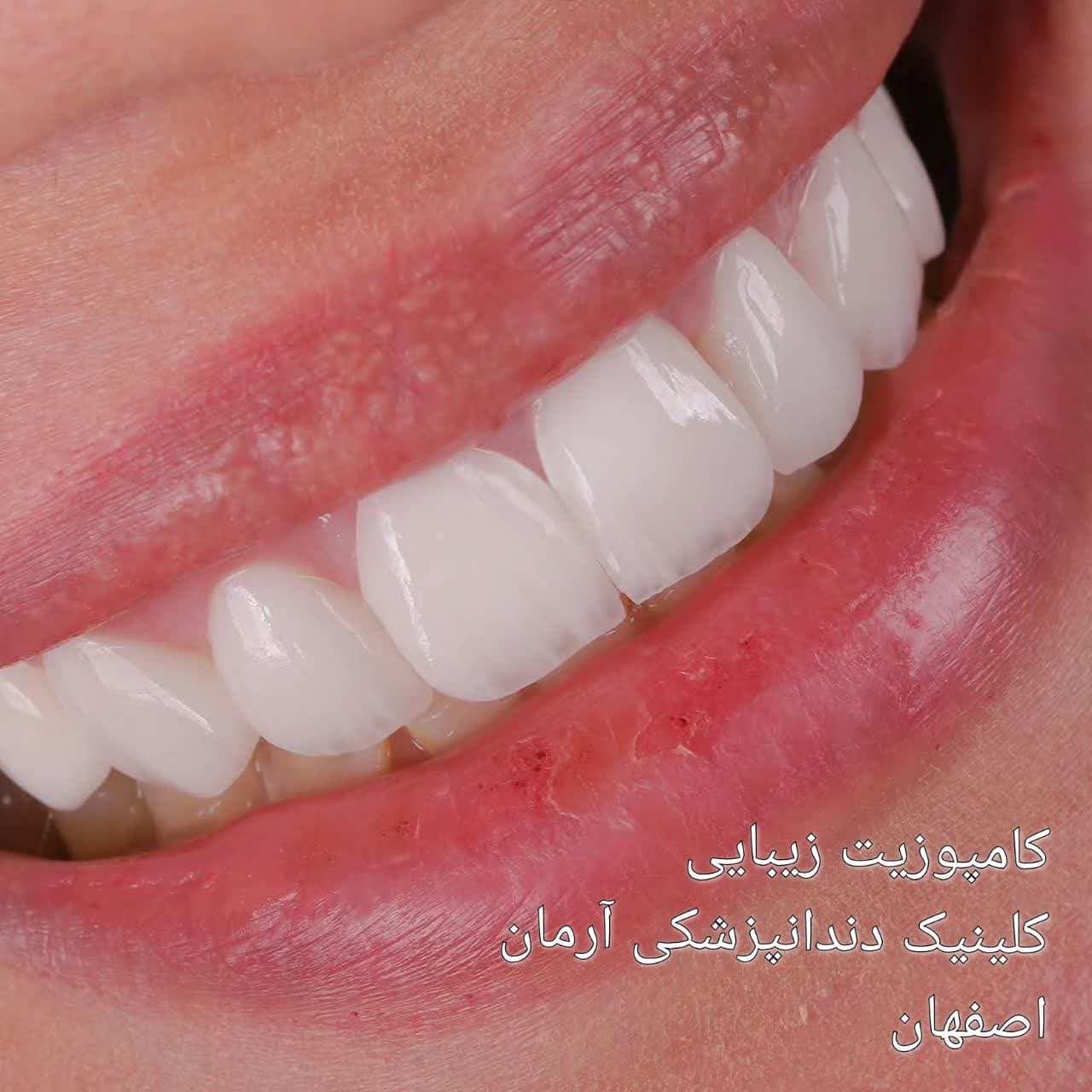 کلینیک دندانپزشکی آرمان اصفهان