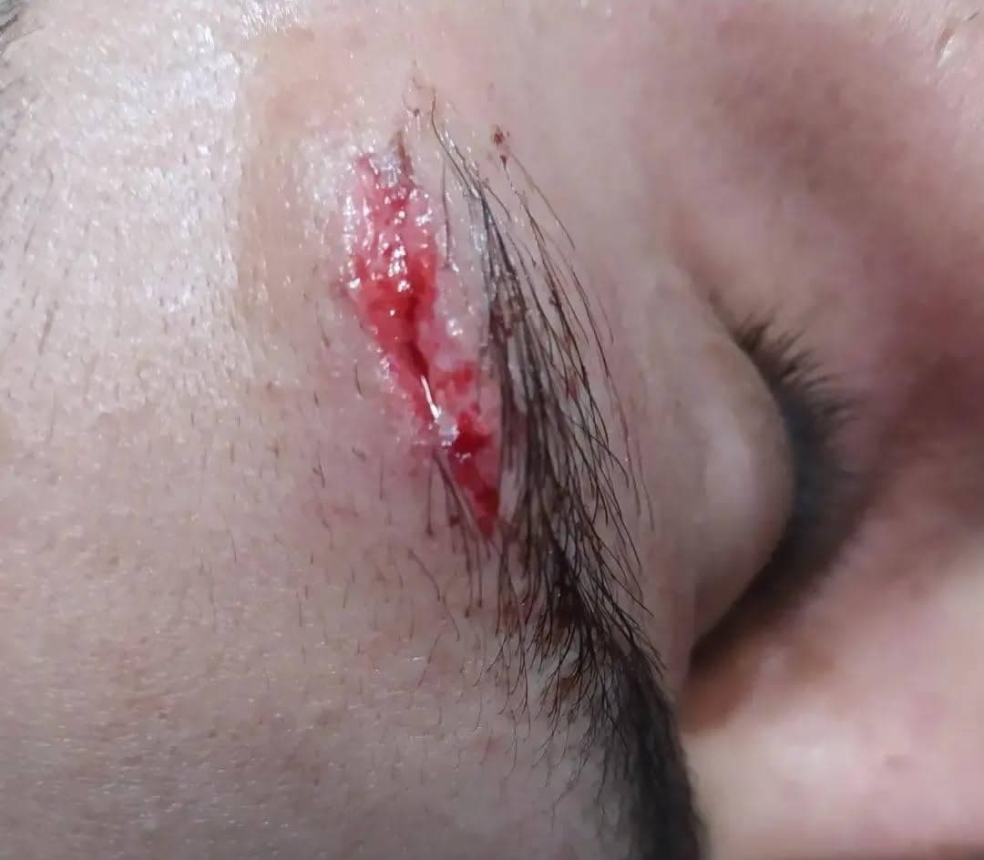 پرستاری و تزریقات در منزل به مدیریت یاسر نوتی زهی در زاهدان