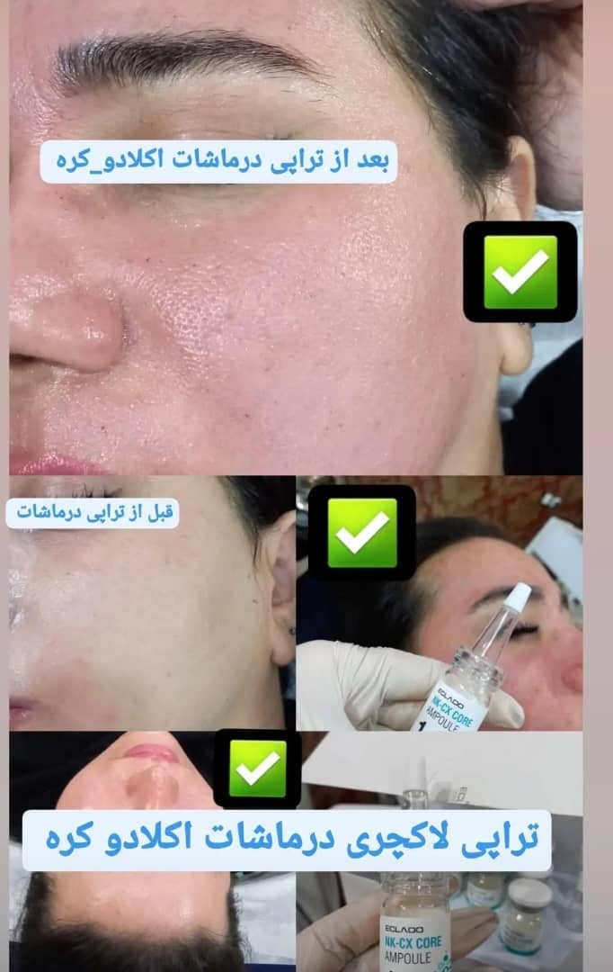 مرکز پاکسازی پوست و زیبایی الهام تقوی در امیدیه