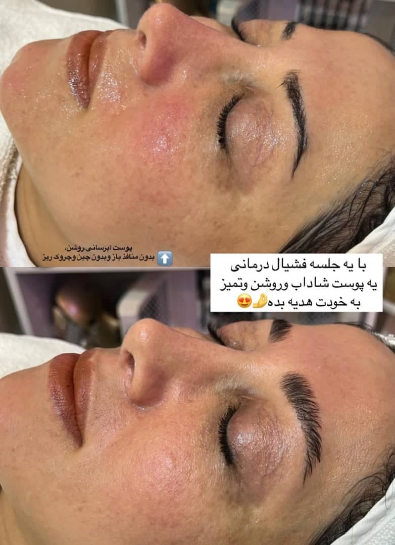 آموزش خدمات پاکسازی و مراقبت از پوست زینب نبی زاده در بابل