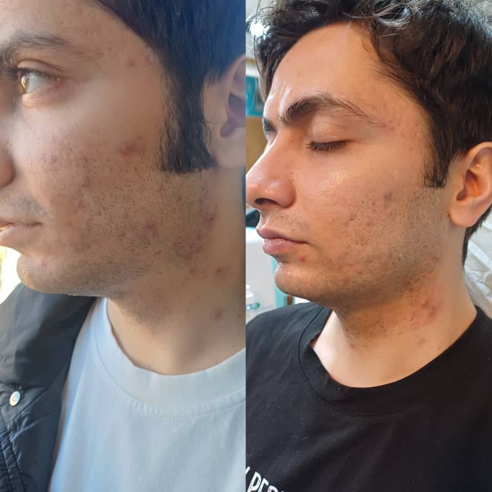 آموزش و خدمات پاکسازی پوست VIP آقایان درشافیشال در اصفهان