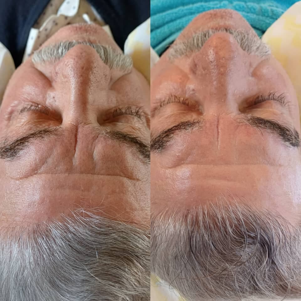 آموزش و خدمات پاکسازی پوست VIP آقایان درشافیشال در اصفهان