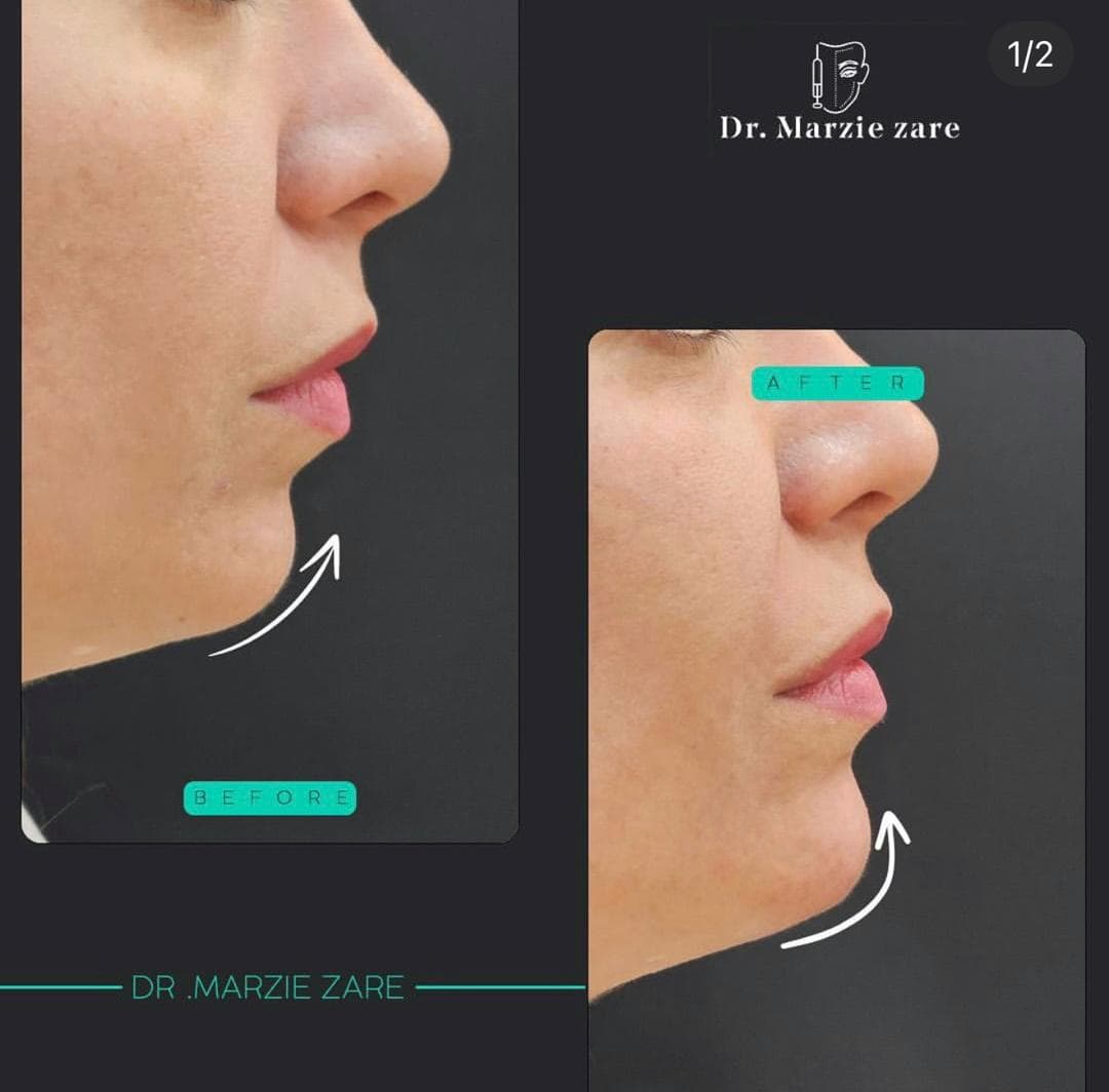 کلینیک زیبایی پوست و مو و لیزر هامین در شیراز