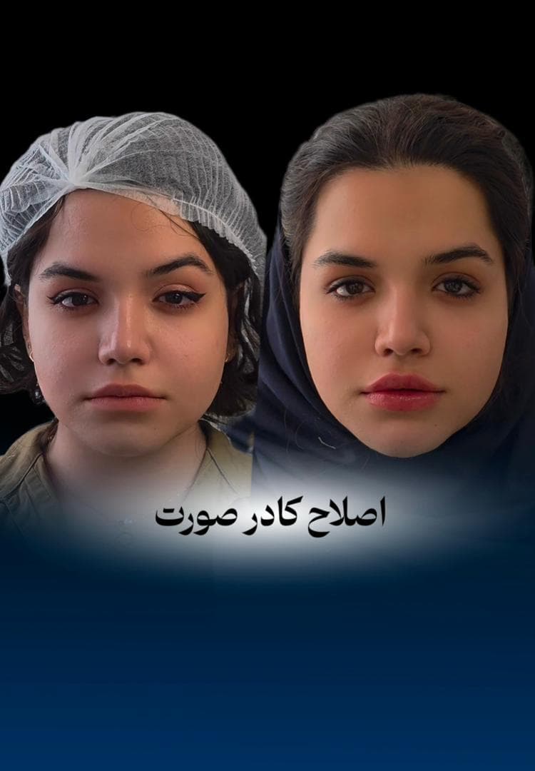 کلینیک زیبایی پوست و مو و لیزر هامین در شیراز