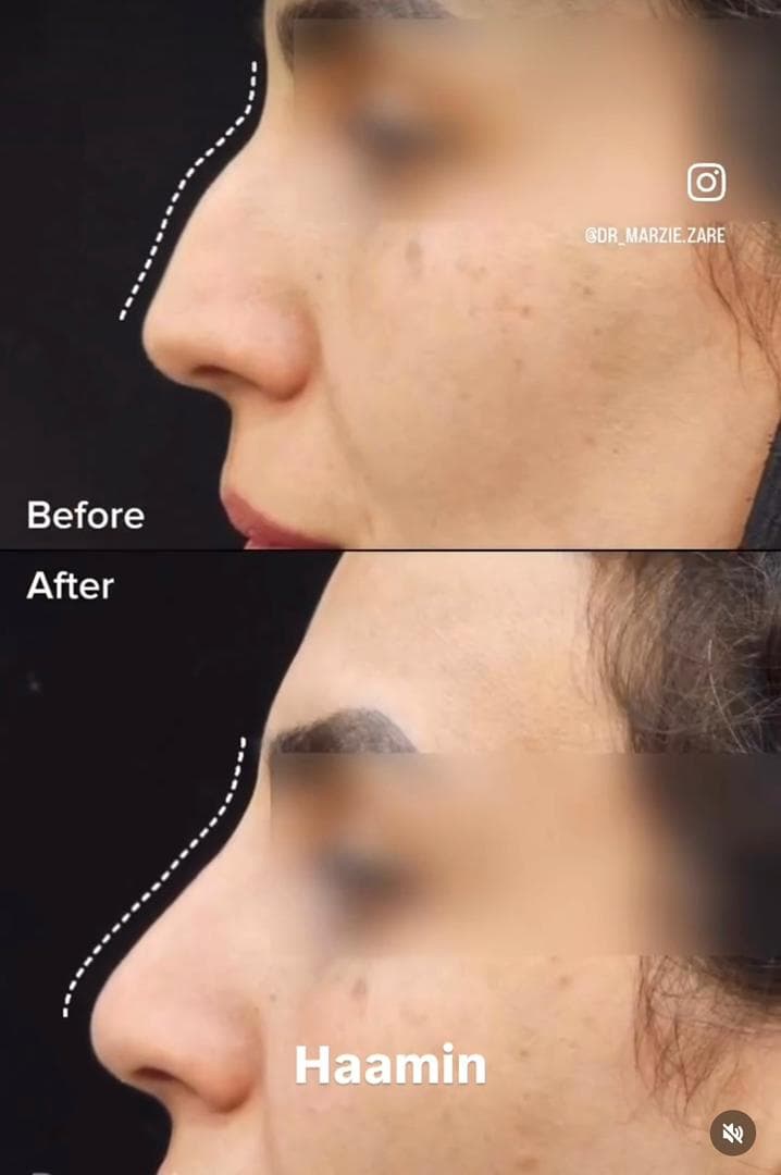 کلینیک زیبایی پوست و مو و لیزر هامین در شیراز