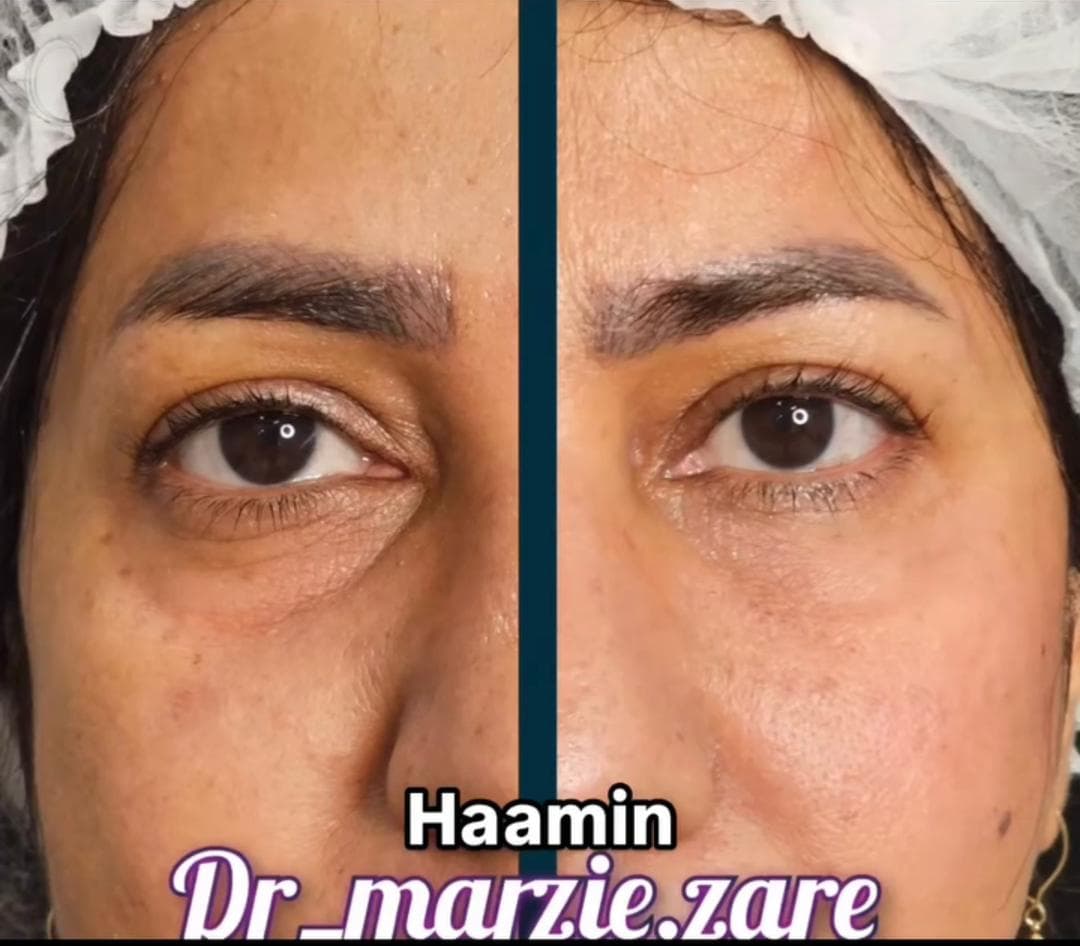 کلینیک زیبایی پوست و مو و لیزر هامین در شیراز