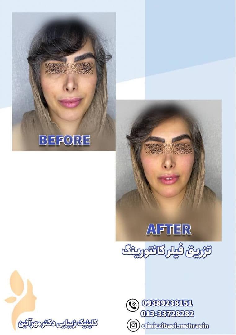 کلینیک زیبایی و جوانسازی و لاغری و لیزر موهای زائد دکتر مهرآئین در رشت