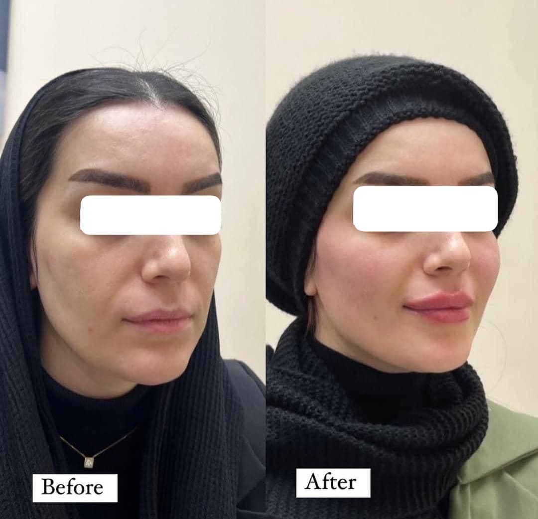 کلینیک زیبایی دانژه دکتر بهنام عمران در بابل