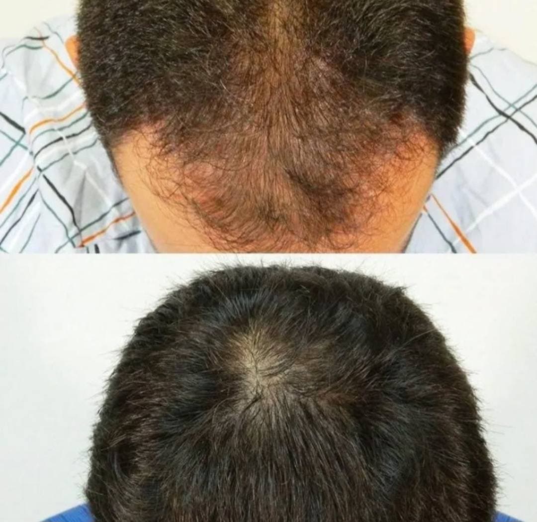 کلینیک زیبایی شانی مانی در خرم آباد