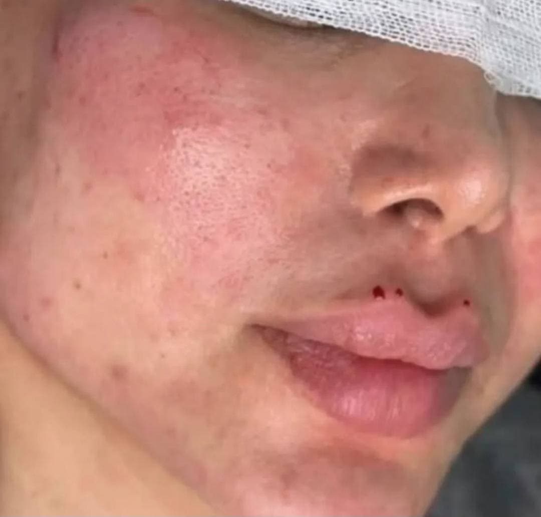 کلینیک زیبایی شانی مانی در خرم آباد