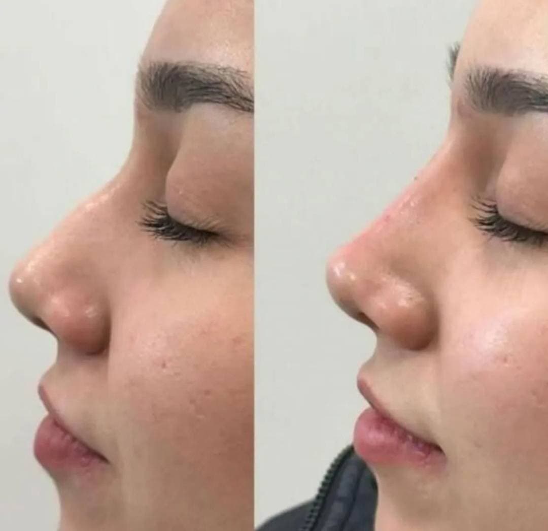 کلینیک زیبایی شانی مانی در خرم آباد