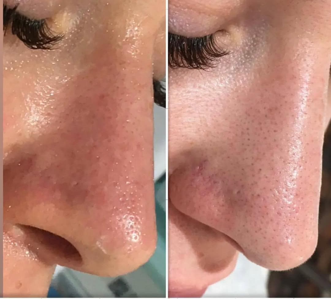 آموزش فیشیال و لیزر موهای زائد آکادمی دکتر سهرابی در نوبهار کرمانشاه