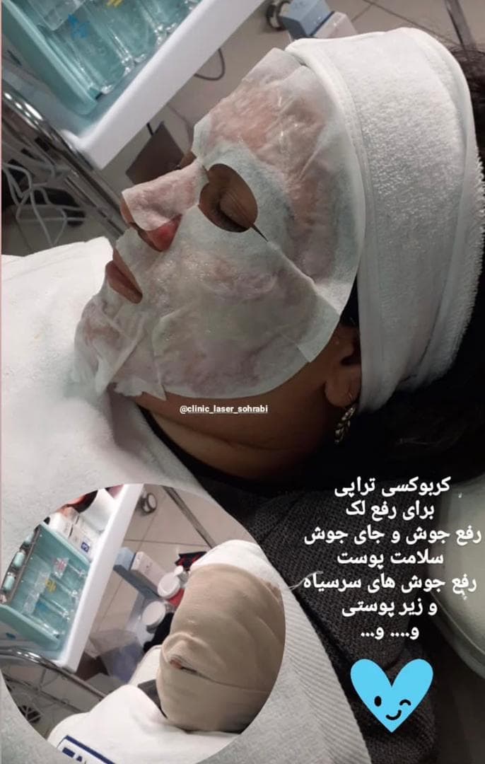 آموزش فیشیال و لیزر موهای زائد آکادمی دکتر سهرابی در نوبهار کرمانشاه