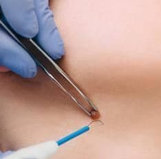 کلینیک تخصصی پوست و مو سینا در ولیعصر تبریز