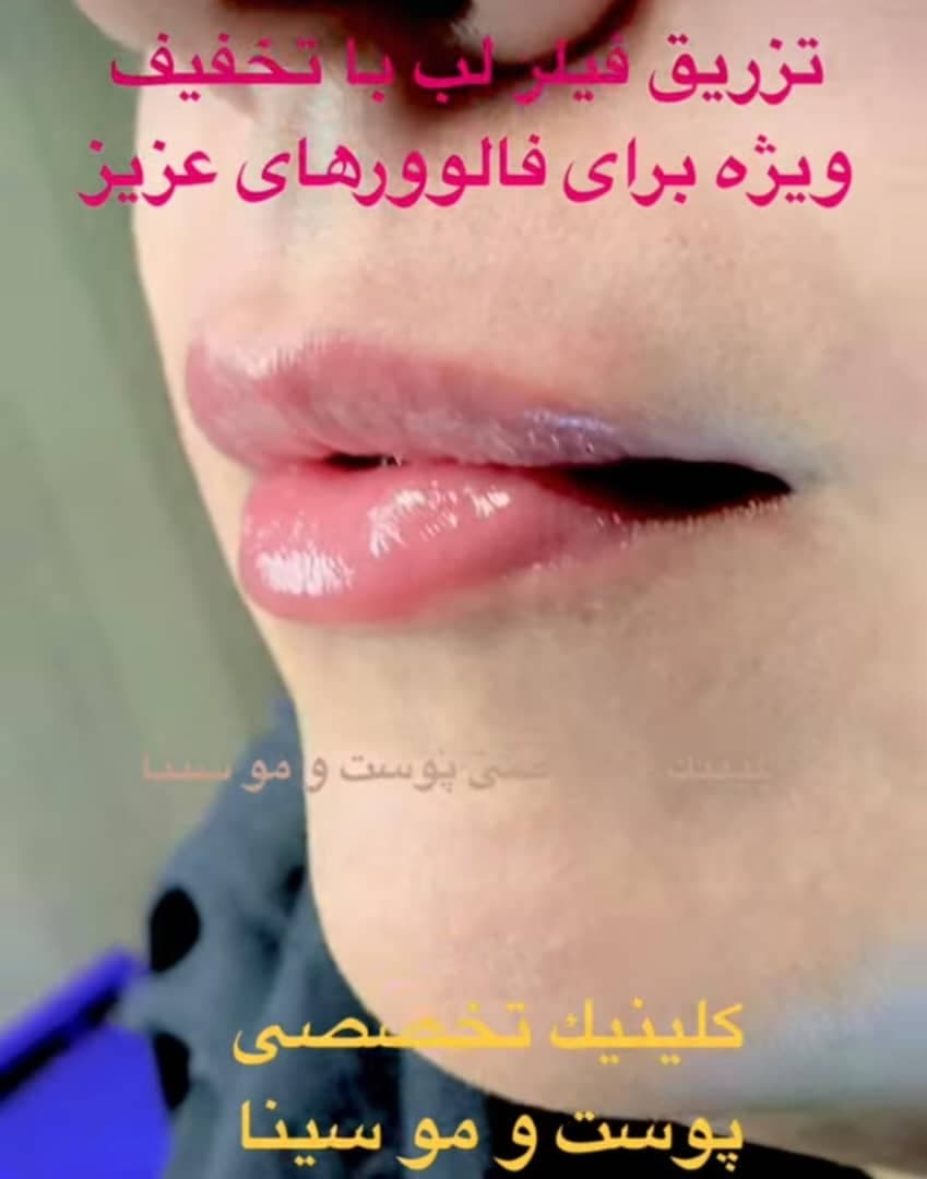 کلینیک تخصصی پوست و مو سینا در ولیعصر تبریز